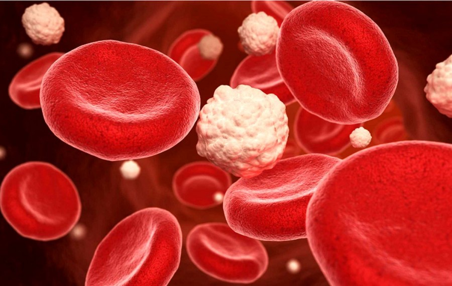 چربی خون / نسخه های طبیعی و خانگی مؤثر برای درمان چربی خون