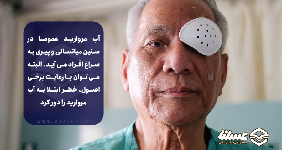 علت بروز آب مروارید چشم