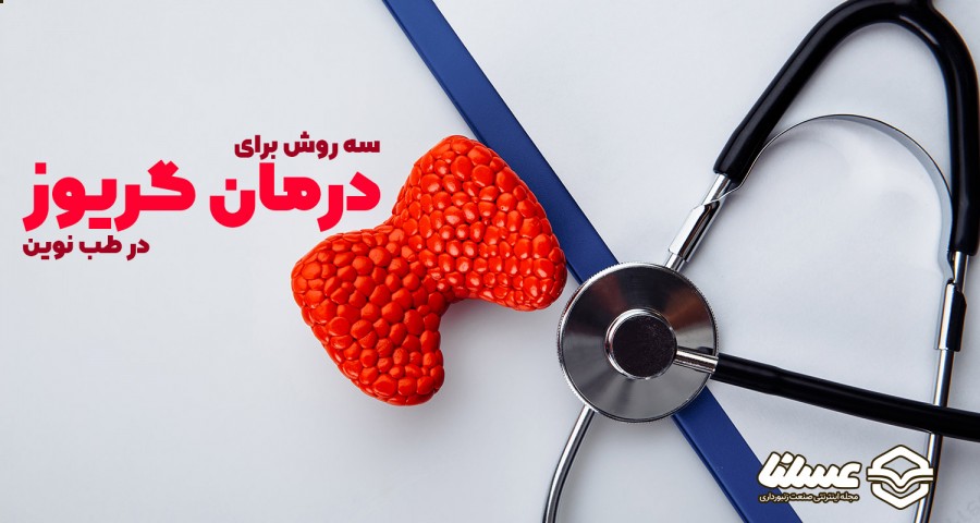 درمان گریوز با دارو و جراحی و ید