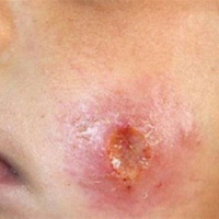 زنبورستان ها را از منطقه پایگاه هشتم شکاری اصفهان دور کنید