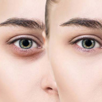 روش های مؤثر برای رفع خستگی چهره /  شادابی پوست صورت با عسل
