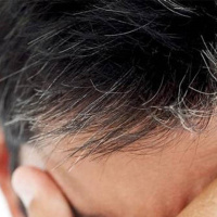 بایدها و نبایدهای جلوگیری از سفید شدن موی سر