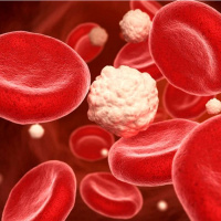 چربی خون / نسخه های طبیعی و خانگی مؤثر برای درمان چربی خون