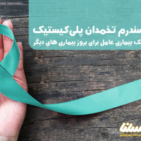 درمان سندروم تخمدان پلی کیستیک با استفاده از ژل رویال