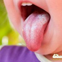 چقدر در مورد درمان برفک دهان با بره موم اطلاعات دارید؟