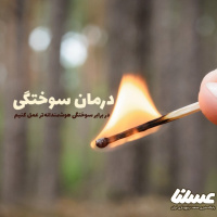  درمان سوختگی با بهترین روش های طبیعی و علمی