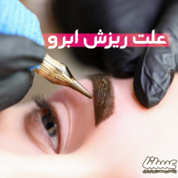 دلایل ریزش ابرو را بشناسیم