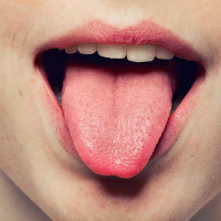 چند نسخه طبیعی برای درمان سوختگی زبان / تسکین سوختگی و التهاب زبان با عسل