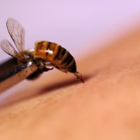 خواص ضد التهابی زهر زنبور عسل / درمان شگفت انگیز بیماری های عفونی تا آلزایمر با زهر زنبور عسل
