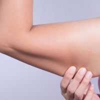 7 راهکار مؤثر برای جلوگیری از شل شدن پوست بعد از کاهش وزن