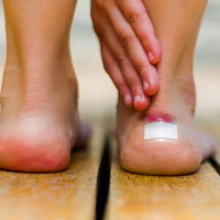 برای جلوگیری از تاول زدن پا در پیاده روی اربعین امسال چه کنیم؟ / التیام سریع تاول پا با عسل