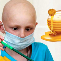 بررسی عسل به عنوان یک درمان برای سرطان در کشورهای در حال توسعه